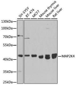 Western blot analysis of extracts of various cell lines, using Anti-MEK4 / MKK4 Antibody (A92939) at 1:1,000 dilution. The secondary antibody was Goat Anti-Rabbit IgG H&L Antibody (HRP) at 1:10,000 dilution.