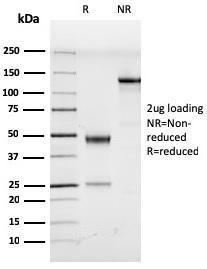 Anti-HHV8 LNA-1 Rat Monoclonal Antibody [clone: LN53]