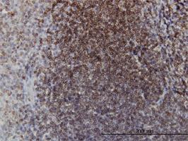 Anti-EPHB3 Mouse Monoclonal Antibody [clone: 2G9]