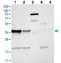 Anti-ZC3H8 Rabbit Polyclonal Antibody