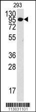 Anti-COL9A1 Rabbit Polyclonal Antibody (FITC (Fluorescein))