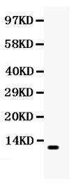 Anti-MCP1 Antibody