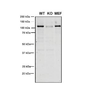 Western blot analysis of Human, mouse A549, MEF showing detection of VPS35 protein using Anti-VPS35 Antibody [8A3] (A305034) at 1:5 (tissue culture supernatant