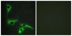 Immunofluorescence analysis of HeLa cells using Anti-TSPAN8 Antibody. The right hand panel represents a negative control, where the antibody was pre-incubated with the immunising peptide