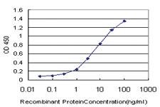 Anti-EPHB3 Mouse Monoclonal Antibody [clone: 2G9]