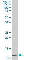 Anti-TIMM9 Mouse Monoclonal Antibody [clone: 1D6]