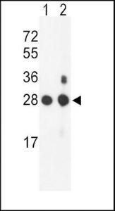 Anti-PSMB1 Rabbit Polyclonal Antibody (AP (Alkaline Phosphatase))