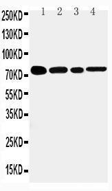 Anti-TNF Receptor II Rabbit Polyclonal Antibody