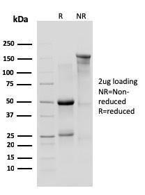 SDS-PAGE analysis of Anti-IL10RA Antibody [1B1.3a] under non-reduced and reduced conditions; showing intact IgG and intact heavy and light chains, respectively. SDS-PAGE analysis confirms the integrity and purity of the antibody.