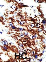 Anti-FDPS Rabbit Polyclonal Antibody