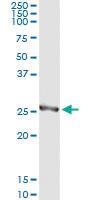 Anti-HPGD Mouse Monoclonal Antibody [clone: 1D8]