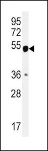 Anti-CALR Rabbit Polyclonal Antibody (APC (Allophycocyanin))