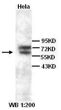 Anti-PDPK1 Rabbit Polyclonal Antibody