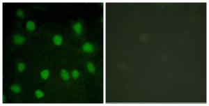 Immunofluorescence analysis of HUVEC cells using Anti-Dematin Antibody. The right hand panel represents a negative control, where the antibody was pre-incubated with the immunising peptide