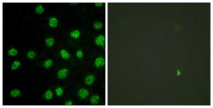 Immunofluorescence analysis of HUVEC cells using Anti-DNA-PK Antibody. The right hand panel represents a negative control, where the Antibody was pre-incubated with the immunising peptide