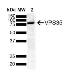 Western blot analysis of human SH-SY5Y showing detection of VPS35 protein using Anti-VPS35 Antibody [8A3] (A305034) at 1:1,000 for 2 hours at room temperature with shakin