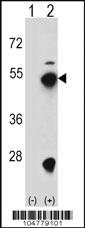 Anti-FDPS Rabbit Polyclonal Antibody