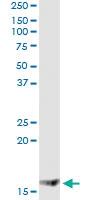 Anti-MGST2 Mouse Monoclonal Antibody [clone: 1D11]