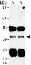 Anti-SIRT7 Rabbit Polyclonal Antibody