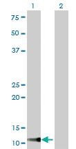 Anti-TIMM9 Mouse Monoclonal Antibody [clone: 1D6]