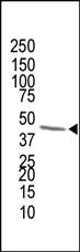 Anti-FDPS Rabbit Polyclonal Antibody