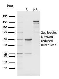 SDS-PAGE analysis of Anti-CD8B Antibody [H35-17.2] under non-reduced and reduced conditions; showing intact IgG and intact heavy and light chains, respectively. SDS-PAGE analysis confirms the integrity and purity of the antibody