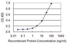 Anti-HPGD Mouse Monoclonal Antibody [clone: 1D8]