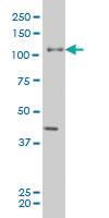 Anti-EPHB3 Mouse Monoclonal Antibody [clone: 2G8]