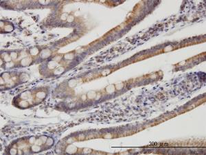 Anti-TIMM9 Mouse Monoclonal Antibody [clone: 1D6]