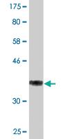 Anti-THOC3 Mouse Monoclonal Antibody [clone: 3D4]