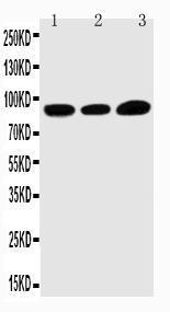 Anti-TRPV3 Rabbit Polyclonal Antibody