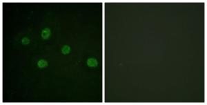 Immunofluorescence analysis of HUVEC cells using Anti-DNA-PK Antibody. The right hand panel represents a negative control, where the antibody was pre-incubated with the immunising peptide