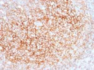 Immunohistochemical analysis of formalin-fixed, paraffin-embedded human tonsil using Anti-CD73 Antibody [NT5E/2545]