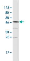 Anti-CNOT7 Mouse Monoclonal Antibody [clone: 2F6]