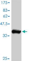 Anti-AKT2 Mouse Monoclonal Antibody [clone: 1B3]