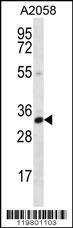 Anti-CNN2 Rabbit Polyclonal Antibody