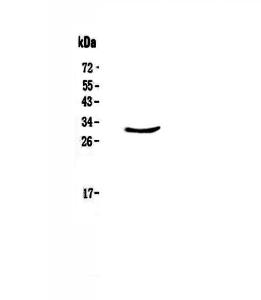 Anti-CLPP Polyclonal Antibody