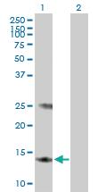 Anti-MGST3 Mouse Polyclonal Antibody