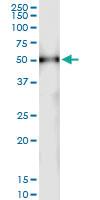 Anti-TUBAL3 Polyclonal Antibody Pair