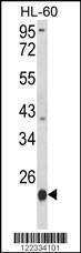 Anti-PSMB9 Rabbit Polyclonal Antibody (APC (Allophycocyanin))