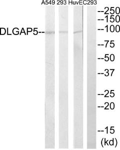 Western blot analysis of lysates from A549, 293, and HUVEC cells using Anti-DLGAP5 Antibody. The right hand lane represents a negative control, where the Antibody is blocked by the immunising peptide