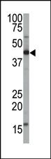 Anti-FNTA Rabbit Polyclonal Antibody