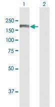 Anti-ALS2 Mouse Polyclonal Antibody