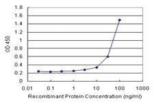 Anti-NOVA1 Antibody Pair