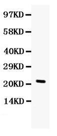 Anti-G-CSF Antibody