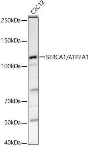 Western blot analysis of C2C12, using Anti-SERCA1 ATPase Antibody (A8528) at 1:1,000 dilution The secondary antibody was Goat Anti-Rabbit IgG H&L Antibody (HRP) at 1:10,000 dilution Lysates/proteins were present at 25 µg per lane