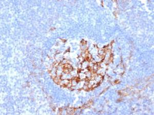 Immunohistochemical analysis of formalin-fixed, paraffin-embedded human tonsil tissue using Anti-CD35 Antibody [CR1/6380] at 2µg/ml