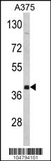 Anti-FNTA Rabbit Polyclonal Antibody