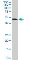 Anti-ARH1 Mouse Monoclonal Antibody [clone: 1F11]