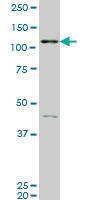 Anti-EPHB3 Mouse Monoclonal Antibody [clone: 3F12]